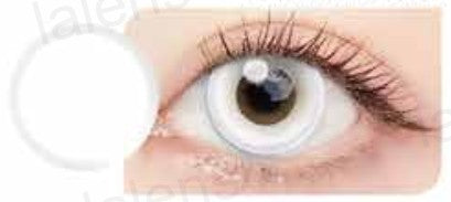 Lentilles de contact LALENS