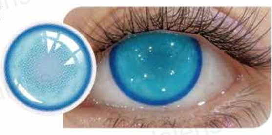 Lentilles de contact LALENS