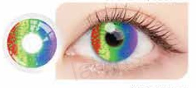 Lentilles de contact LALENS